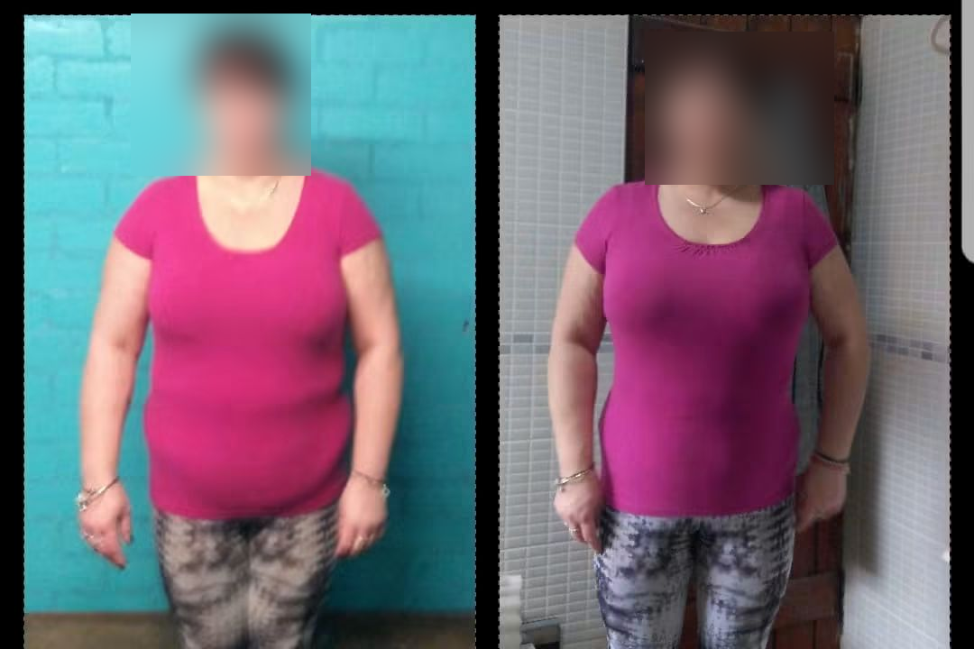 Before and after: a client's steady weight loss progress, face blurred