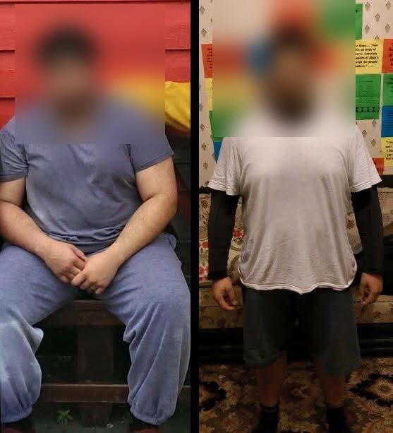 Before and after: a client's substantial weight loss transformation, faces blurred