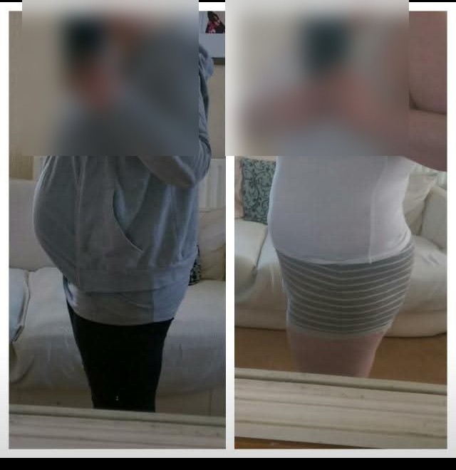 Side-by-side views of a client's fat loss progress, face obscured
