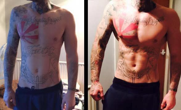 Before and after: a client's abdominal definition transformation, face blurred
