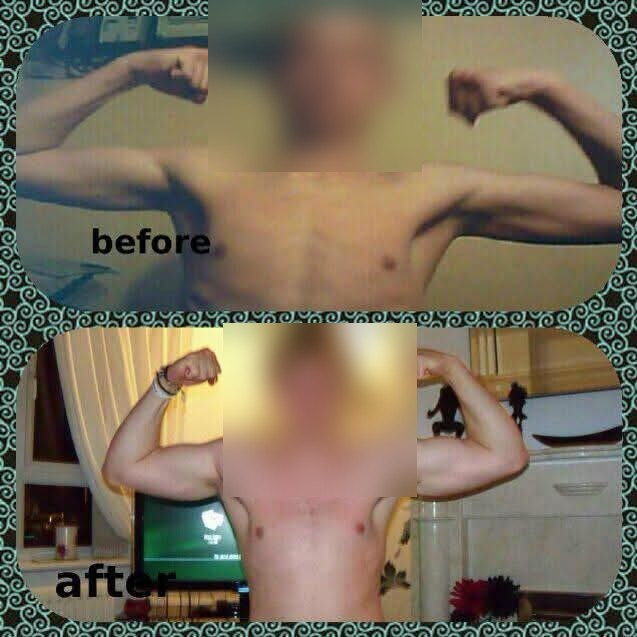 Before and after: a client's arm and upper-body muscle gain, faces blurred
