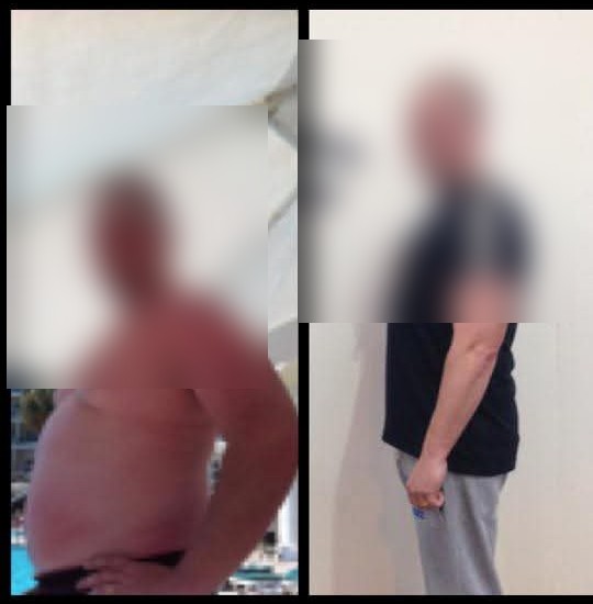 Before and after: a client's substantial weight loss transformation, faces blurred