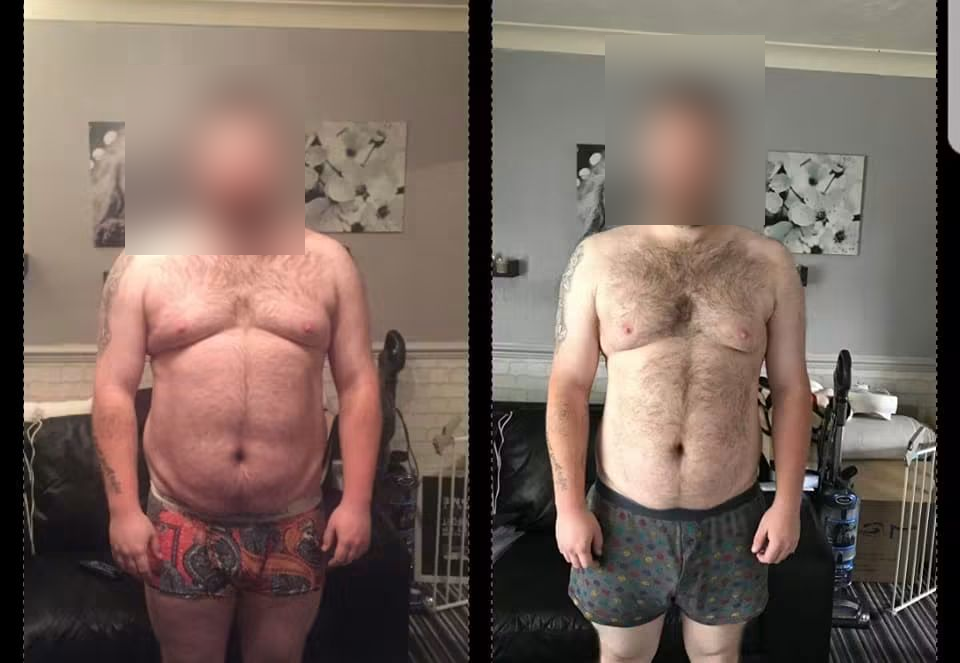 Before and after: a client's major fat loss transformation, face blurred