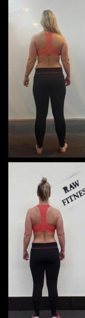 Before and after: a client's back and posture transformation, face blurred